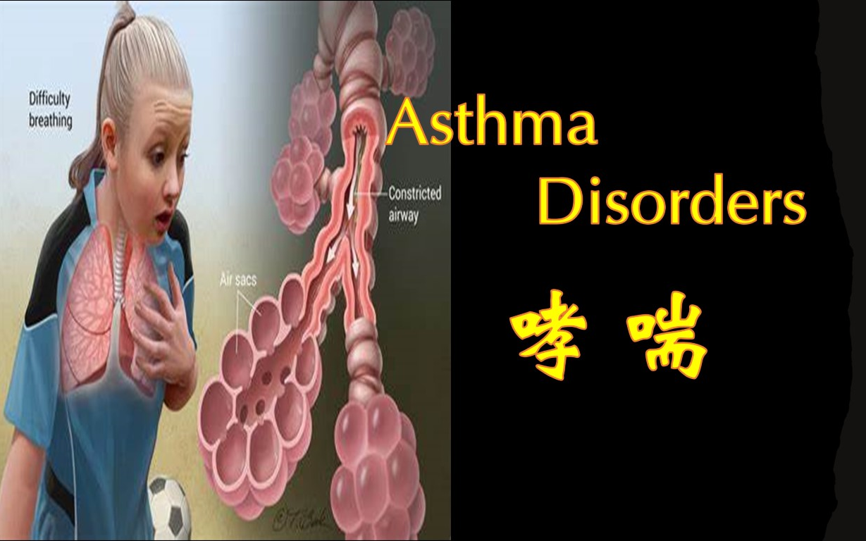 哮喘 | Asthma哔哩哔哩bilibili