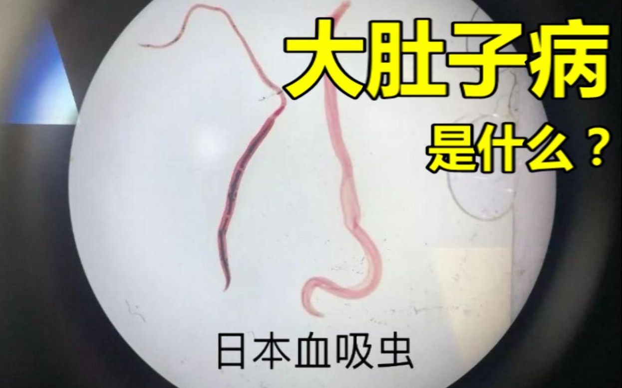 下落说大肚子病天花蝗灾为何在建国后逐渐消失