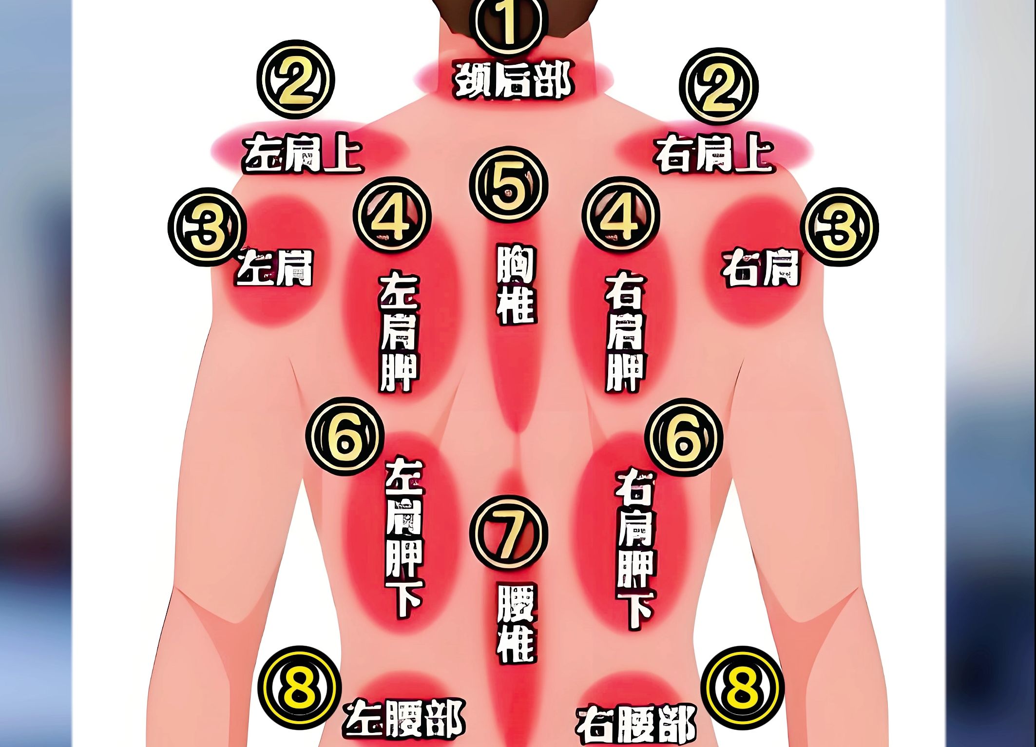 后背不同位置疼痛