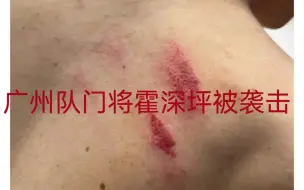 Download Video: 大连英博0：1广州队，赛后广州队门将霍深坪被袭击