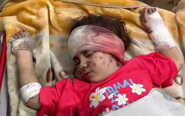 巴以冲突,巴勒斯坦儿童伤情