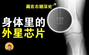 Descargar video: 进入巨型UFO内部，身体遭植入外星芯片，被政府掩盖近40年的真相【怪奇说】