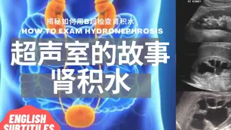 肾积水：肾积水是什么/什么人容易得肾积水/肾积水的症状和类型/B超是如何检查肾积水的/预防和治疗