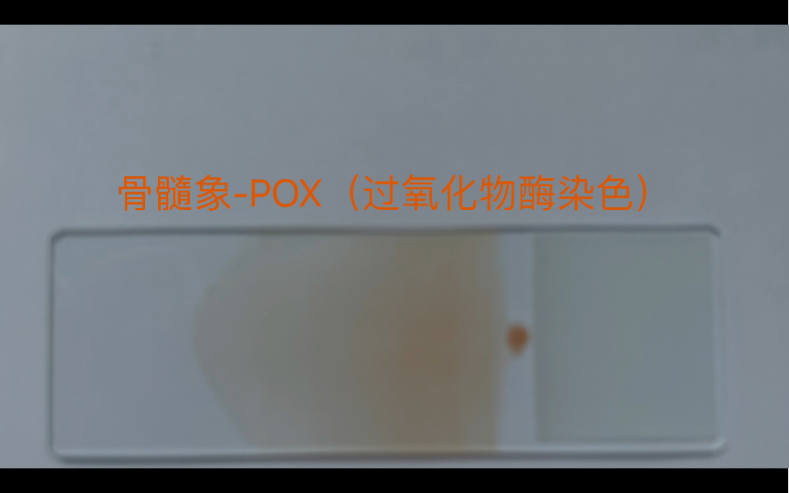 骨髓象POX染色(过氧化物酶染色)哔哩哔哩bilibili