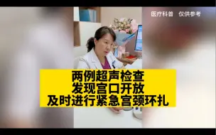 Tải video: 两例超声检查，发现宫口开放，及时进行紧急宫颈环扎！