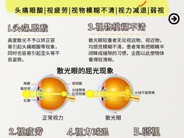 跟近视一样,散光不可治愈、不可逆.面对散光,我们一定要做到早发现,早矫正.哔哩哔哩bilibili