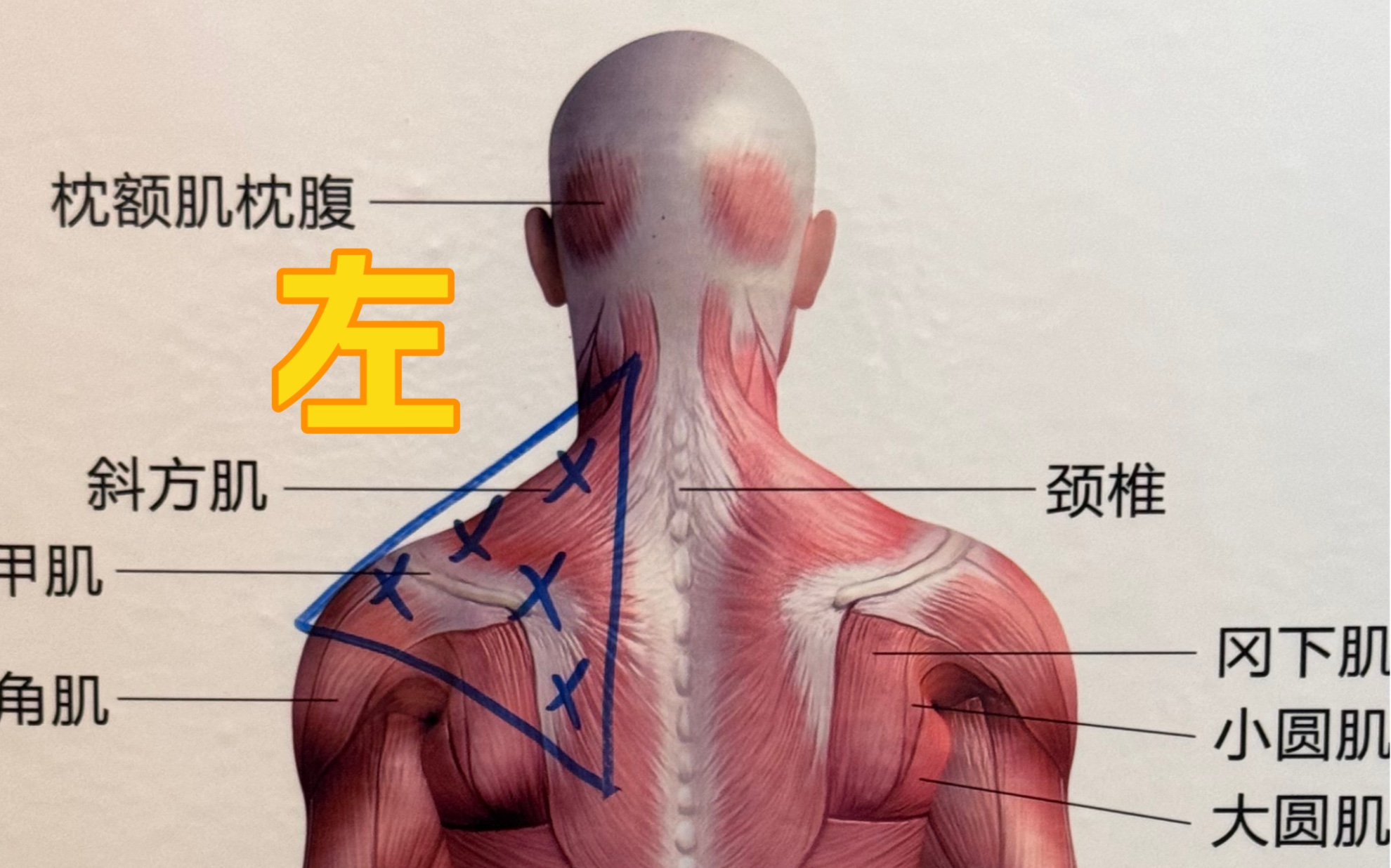 有问题的地方,是缺少弹性,而不是越少张力!哔哩哔哩bilibili