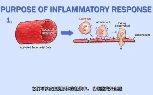 Download Video: 炎症的发生（看完觉得通透了！免疫病理生理不分家）