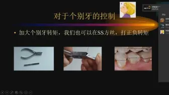 Tải video: 中级正畸简单学-第一节