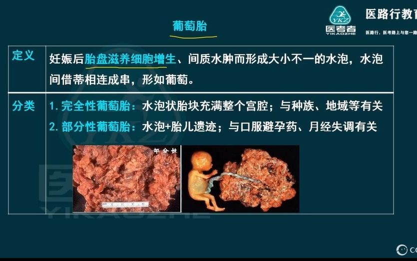 [图]医路行2023年临床-妇产科学11-2(妊娠滋养细胞+子宫内膜异位+腺肌病).wmv