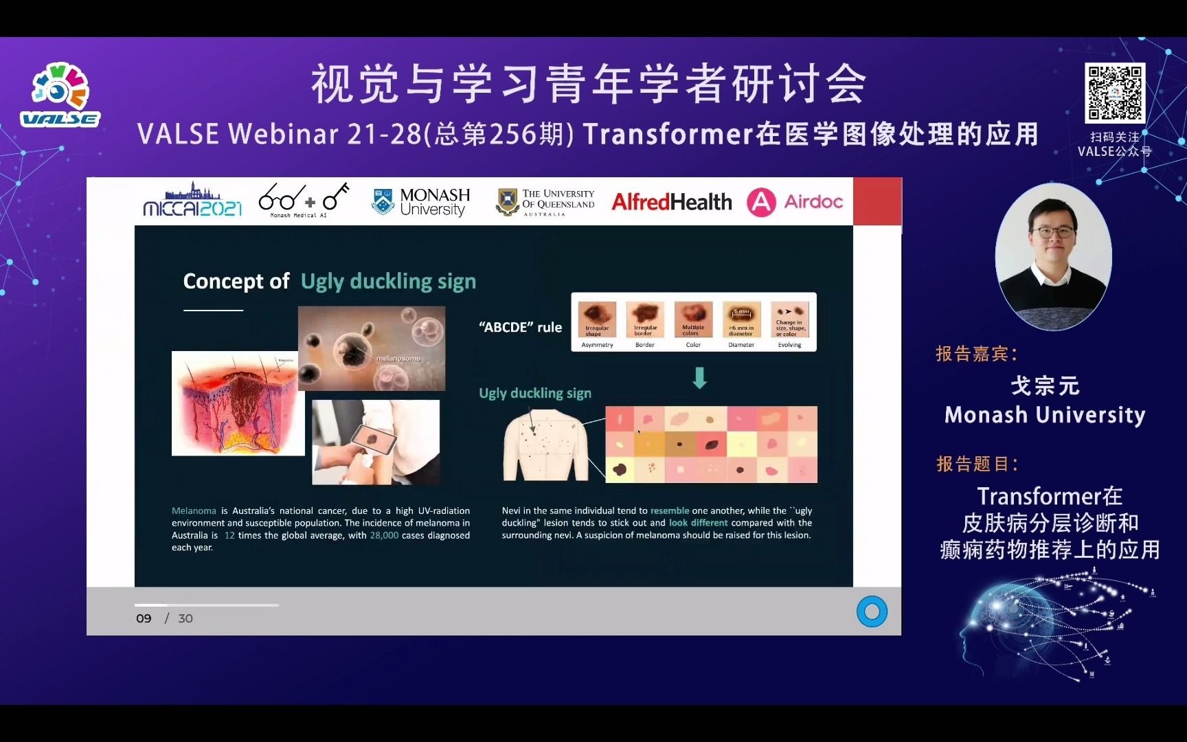 20211021【Transformer在医学图像处理的应用】戈宗元:Transformer在皮肤病分层诊断和癫痫药物推荐上的应用哔哩哔哩bilibili