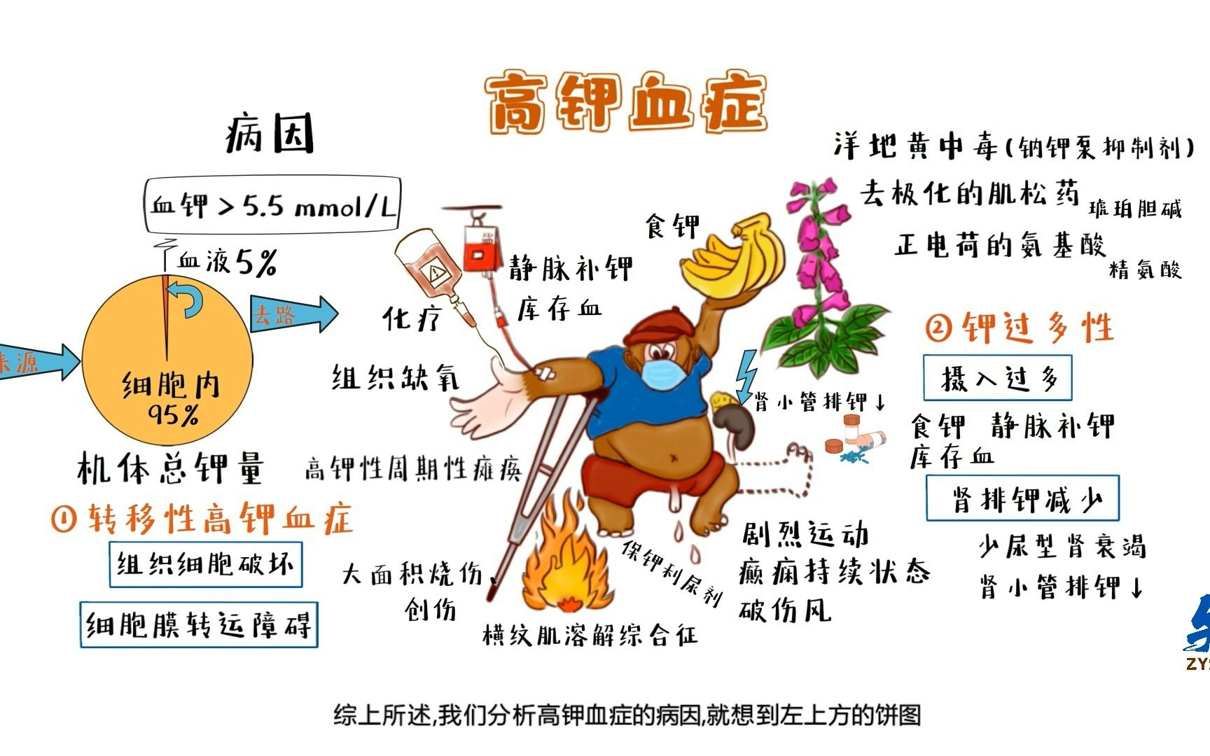 【绘画 诊断学 】2分钟掌握 高钾血症