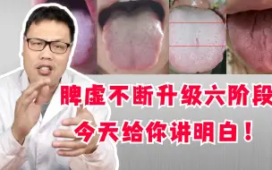 Télécharger la video: 脾虚为何久治不愈？脾虚不断升级的6个阶段，今天给你讲明白！