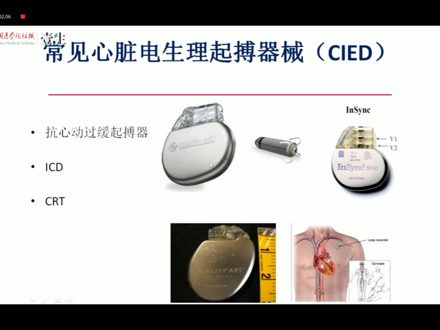 Day30 ICD与CRT的原理及临床应用哔哩哔哩bilibili