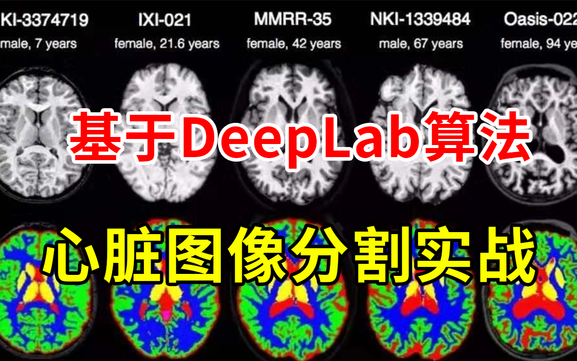 【医学图像分割实战】基于DeepLab算法实现心脏图像分割,原理详解+项目实战,学不会来打我!(人工智能/计算机视觉)哔哩哔哩bilibili