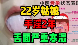 Descargar video: 22岁小姑娘，频繁手淫2年，舌头严重寒湿，不爱惜自己身体！