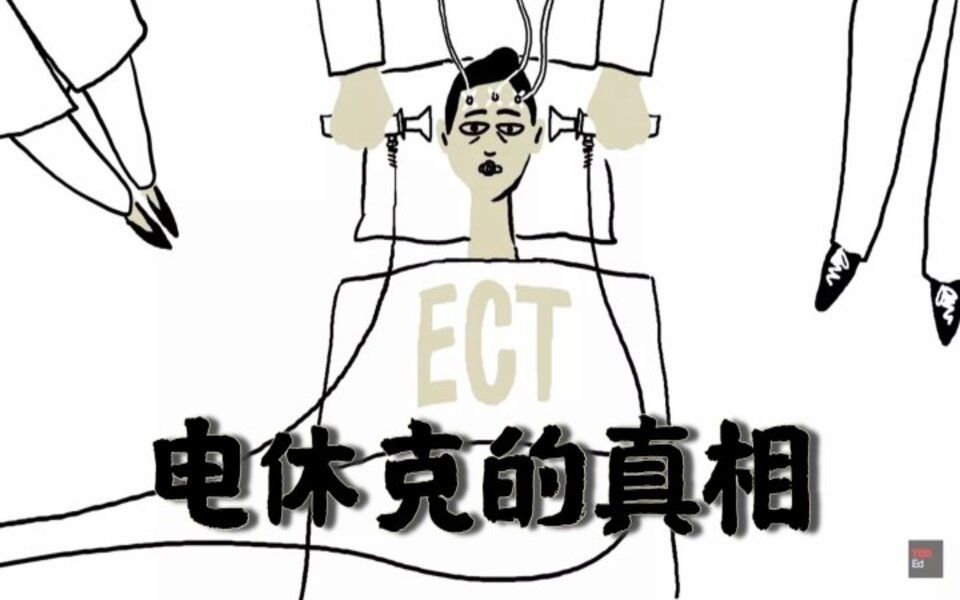 [图]TED双字｜电大脑是为了治疗抑郁症, 不是上刑..｜ECT电休克疗法的真相｜疗效&副作用｜The truth about ECT中英字幕