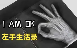 手残 指右手骨折 哔哩哔哩 Bilibili 手残 指右手骨折 哔哩哔哩 Bilibili