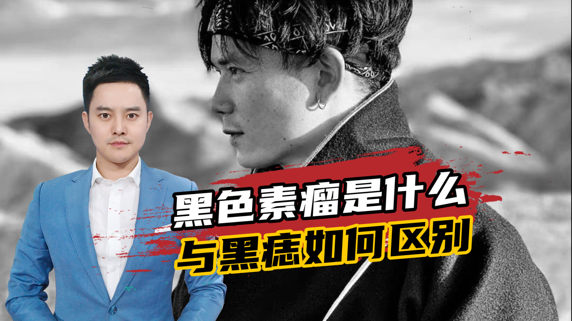 好声音亚军张恒远去世,这个黑色素瘤是什么?与黑痣如何区别?