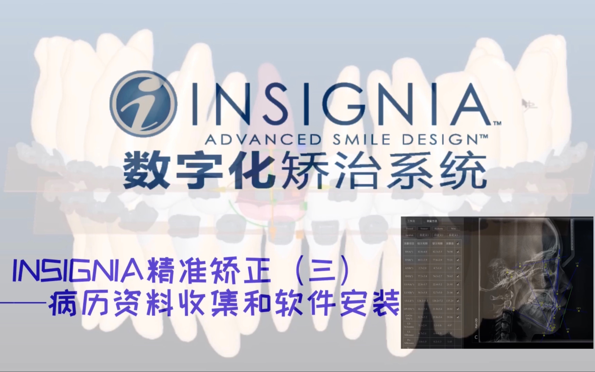 INSIGNIA精准矫正(三)——病历资料收集和软件安装哔哩哔哩bilibili