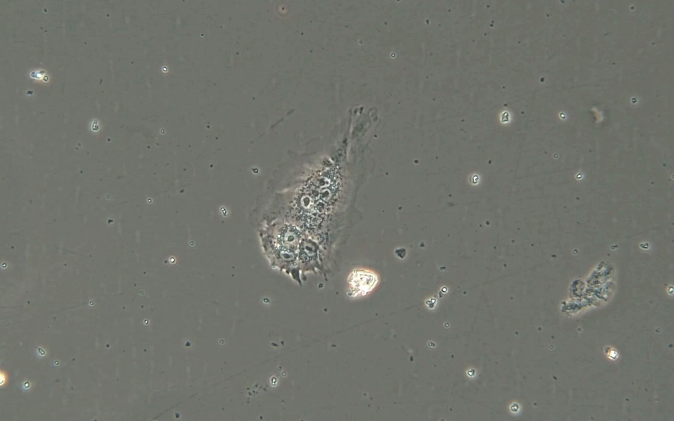 4T1小鼠乳腺癌多倍体肿瘤巨细胞(PGCCs)细胞分裂现场哔哩哔哩bilibili