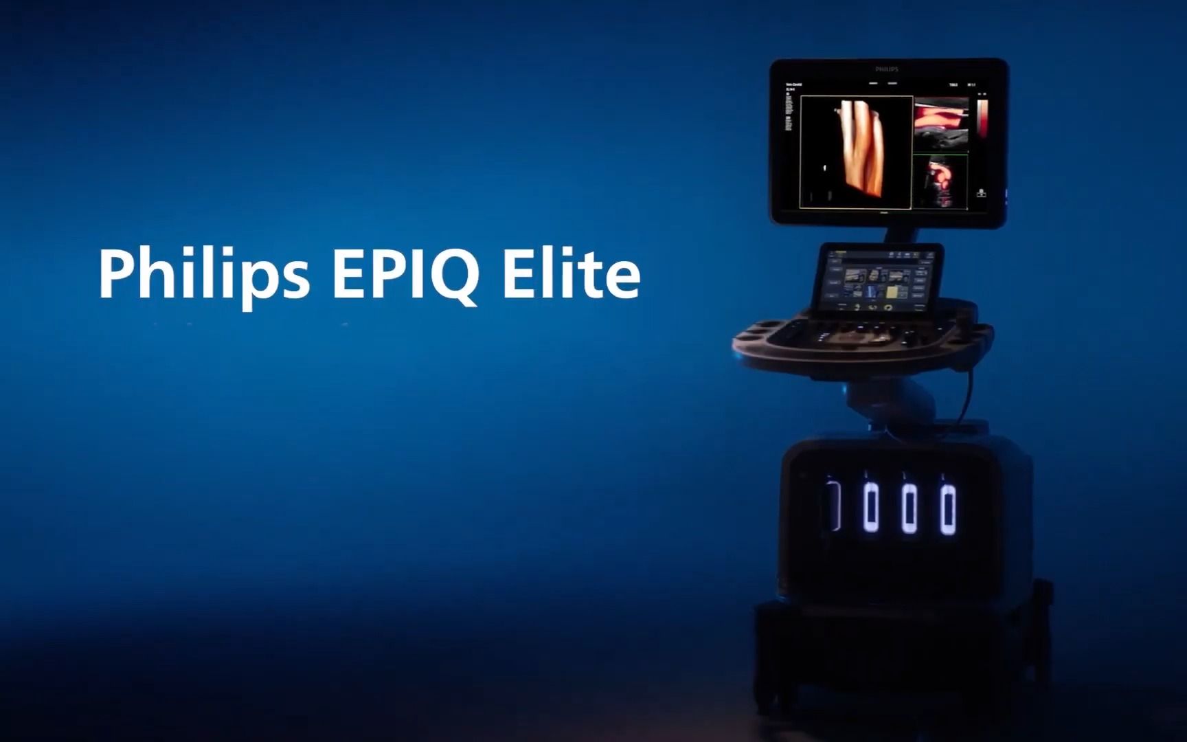 飞利浦医疗发布最新超声产品 EPIQ Elite哔哩哔哩bilibili