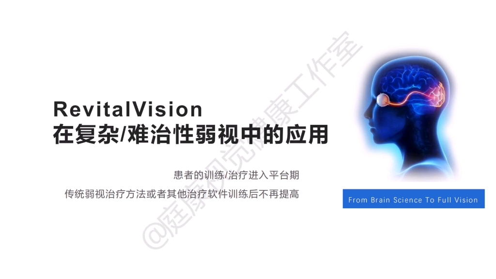 分享一下立唯图RevitalVision在大龄弱视成人弱视中的相关应用及case~哔哩哔哩bilibili