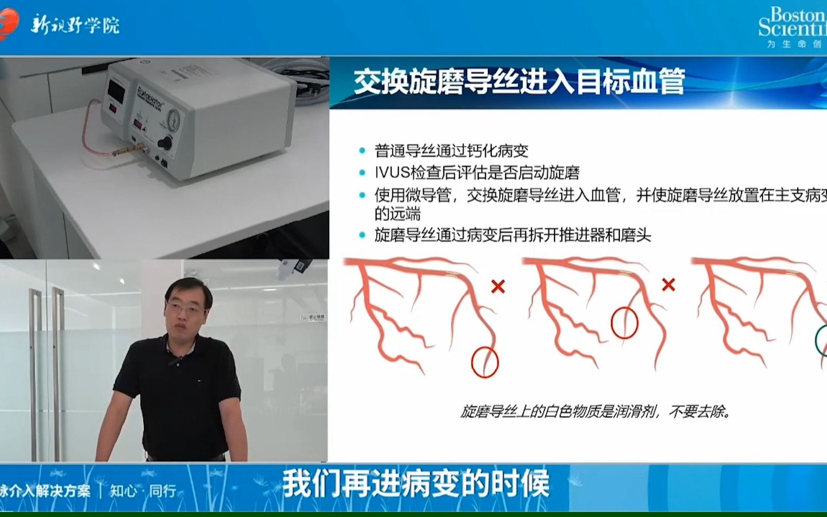 波科Rotablator旋磨治疗系统连接及操作讲解 崔锦刚教授哔哩哔哩bilibili