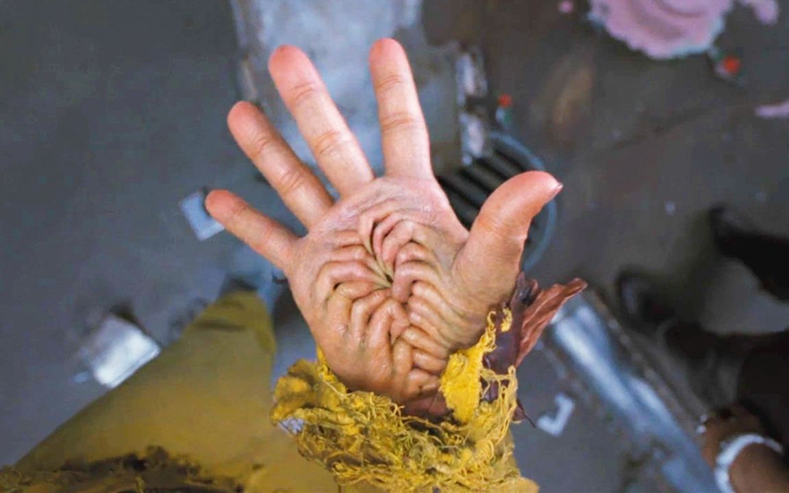 男子的手掌,长有一排"牙齿",能释放出"骨刺"!