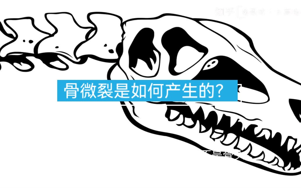 骨微裂是如何产生的