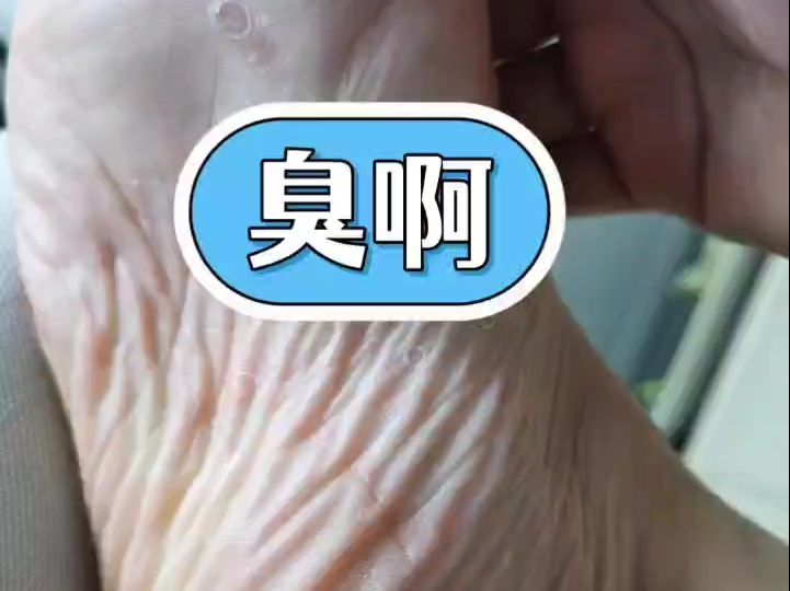 这臭脚丫太恼人了走哪儿都被嫌弃