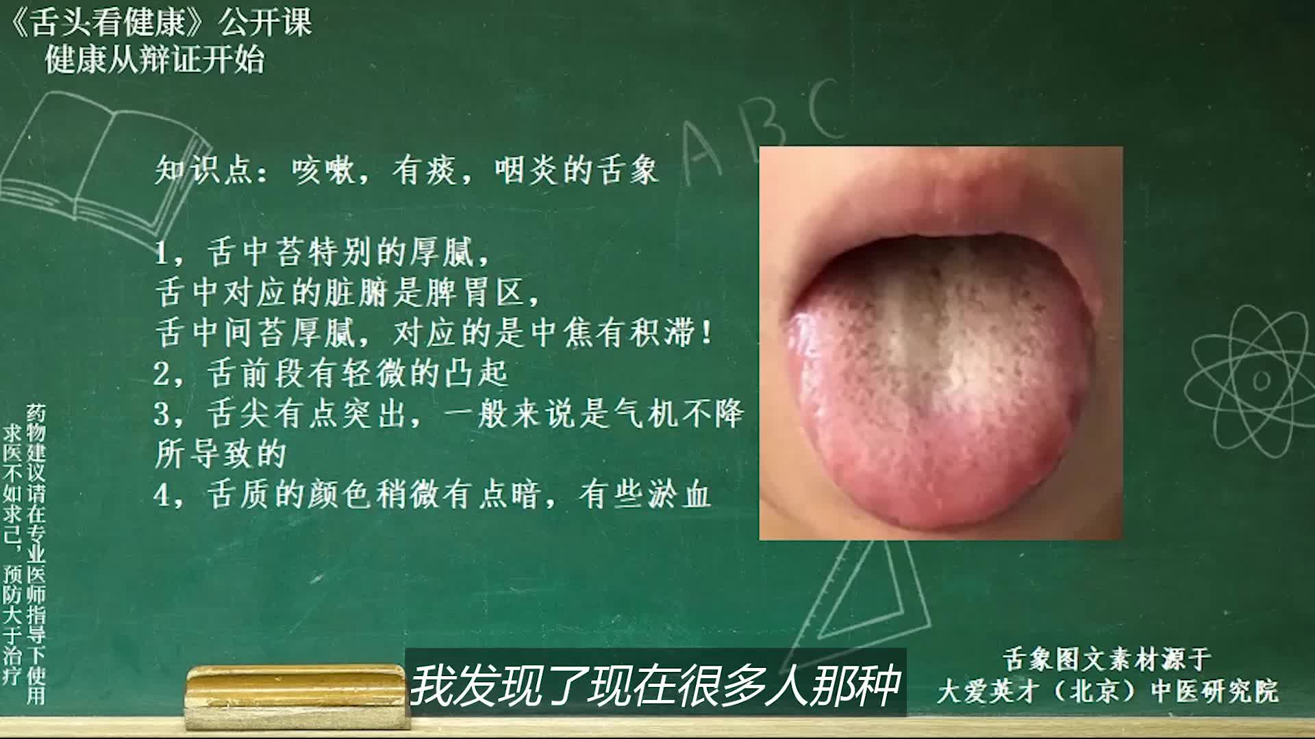 舌象分析:喉咙不舒服,咳嗽有痰,舌苔厚腻,痰湿凝阻的舌象讲解哔哩哔哩bilibili