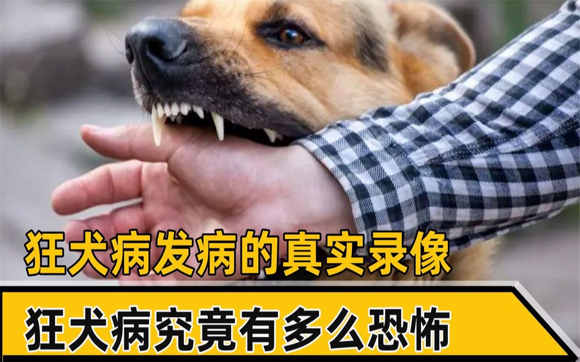 狂犬病发病的真实录像,浑身抽搐生不如死,狂犬病究竟有多么恐怖哔哩哔哩bilibili