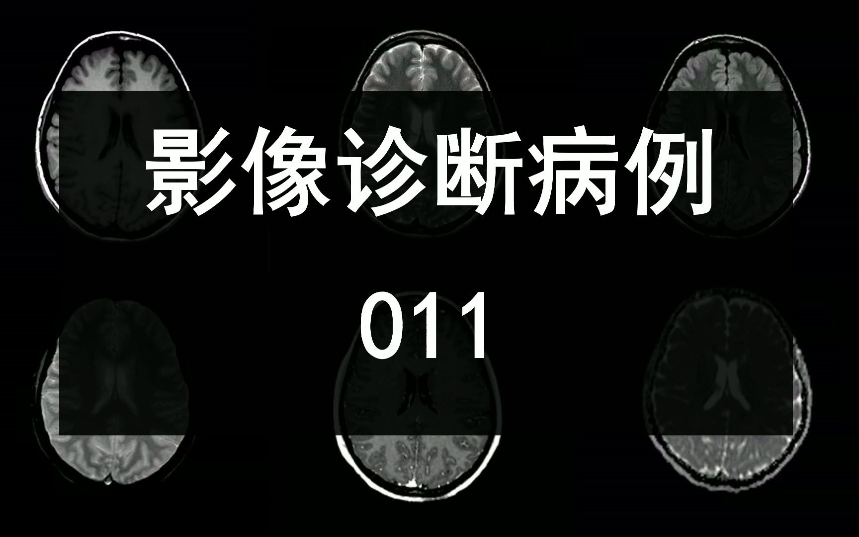 医学影像诊断病例 011期哔哩哔哩bilibili