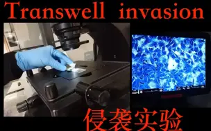 Transwell侵袭实验