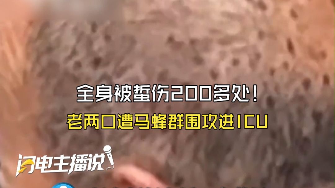 全身被蜇伤200多处！老两口路上行走 突遭马蜂群围攻进ICU