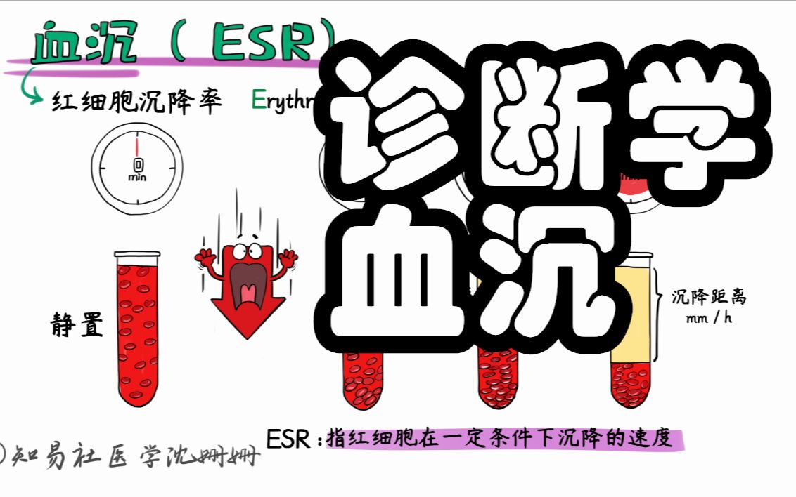 医学带背 5分钟理解 血沉(ESR)检测的原理哔哩哔哩bilibili