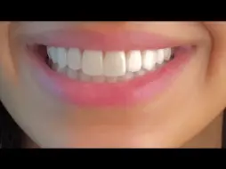 Download Video: ღ your teeth are literally perfect! ~ veneers procedure 💉