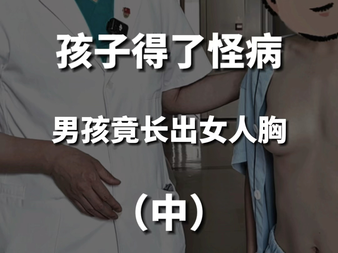 男孩竟长出女人胸,男性乳腺也会发育!哔哩哔哩bilibili