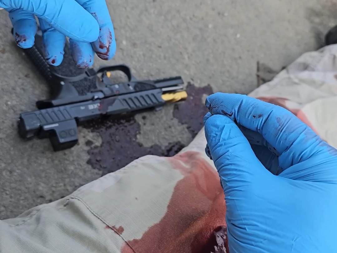 如果大腿中弹了,先不要慌!