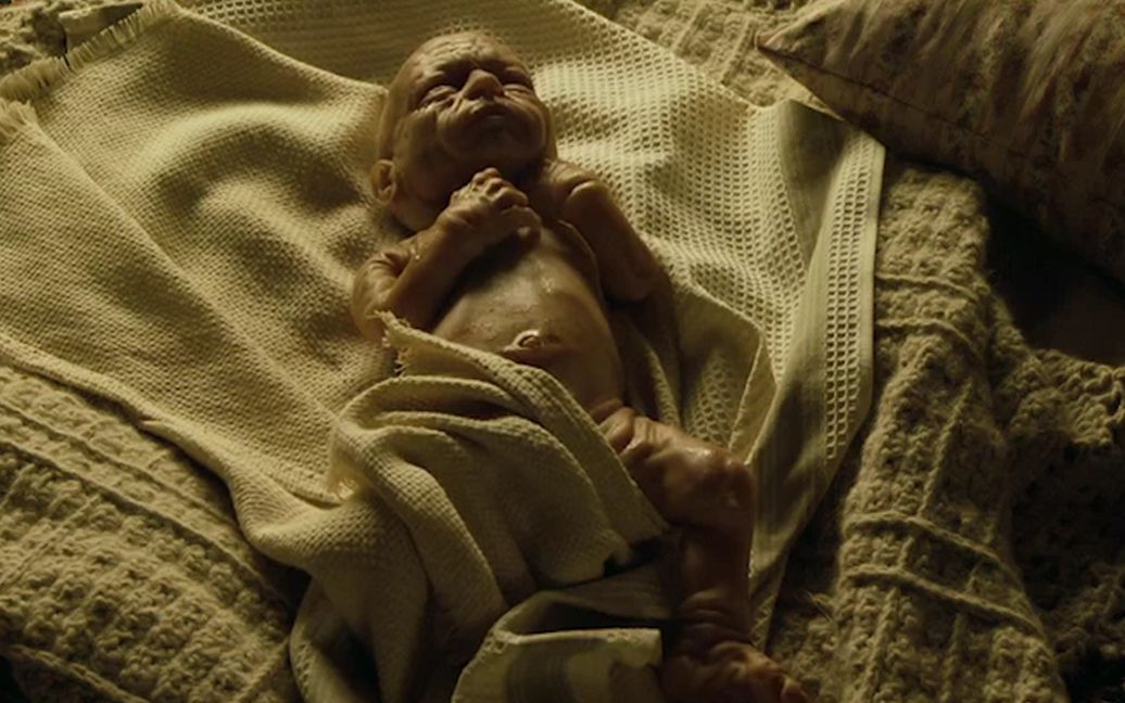 婴儿满脸皱纹像老头,刚出生母亲就难产去世,父亲吓的扔掉孩子_哔哩