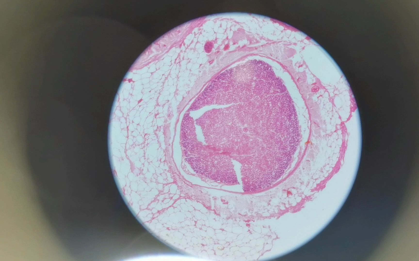 中央静脉显微镜图图片