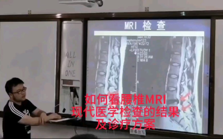 [图]腰椎的评估：如何看腰椎MRI现代医学检查的结果及诊疗方案