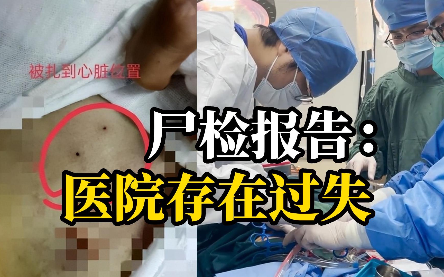 4岁女童穿刺死亡,父亲怀疑医生操作失误哔哩哔哩bilibili