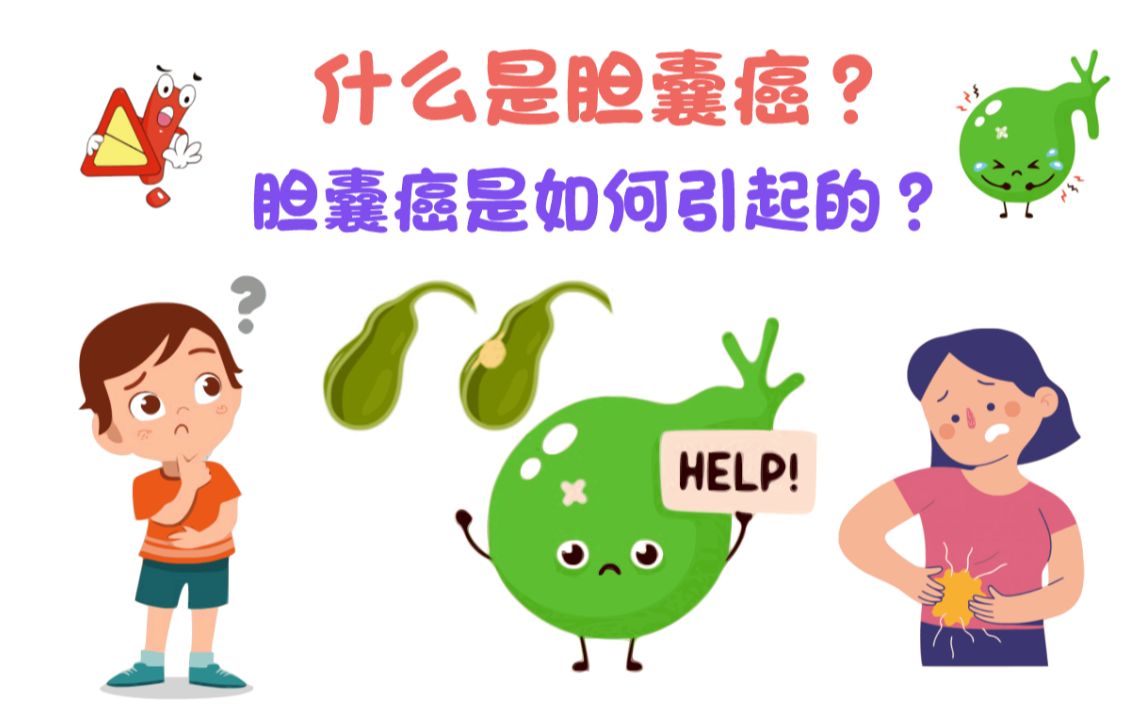 【胆囊癌篇】什么是胆囊癌?胆囊癌是如何引起的?哔哩哔哩bilibili