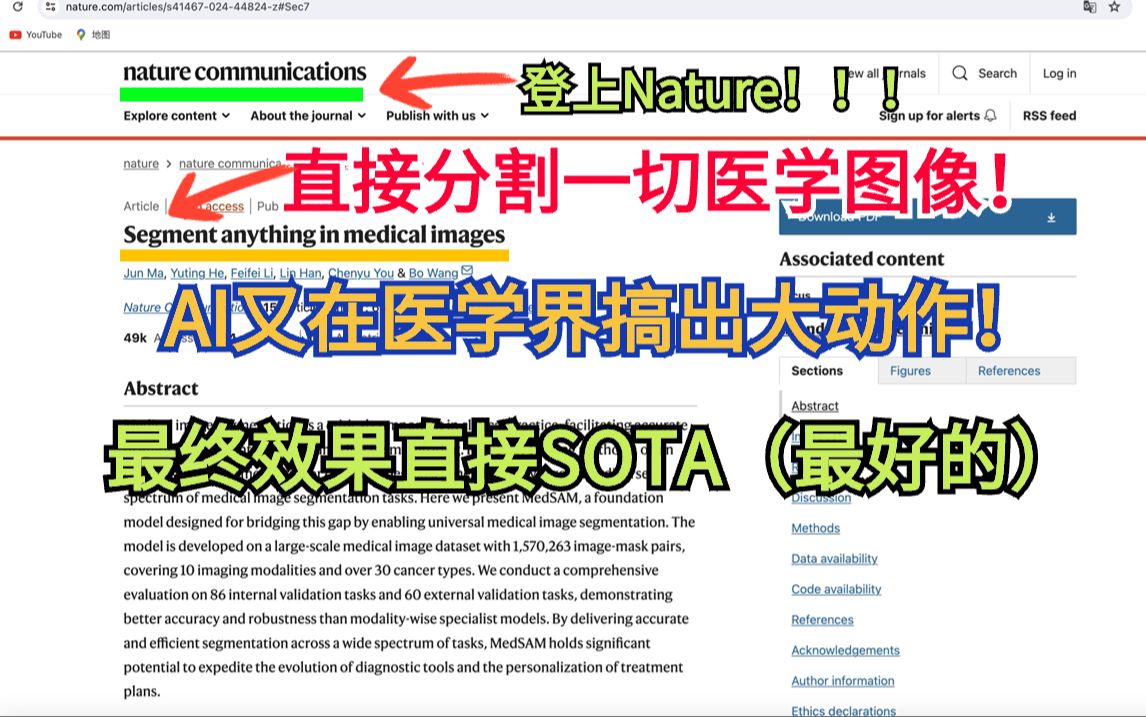 医学图像迎来专属分割一切模型!AI模型MedSAM登上Nature communications!!深度学习/神经网络哔哩哔哩bilibili