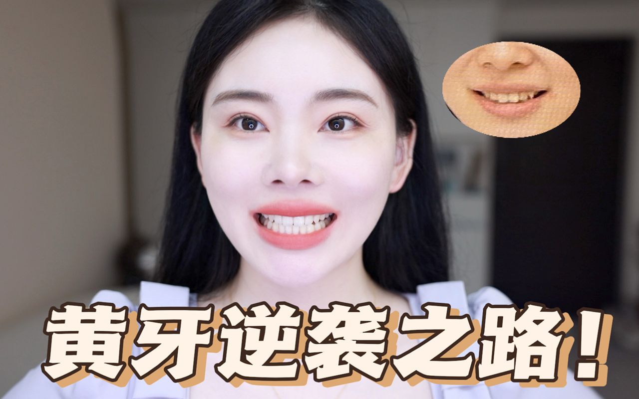 7天牙齿净白挑战,牙套人也不用再担心做小黄鸭了!