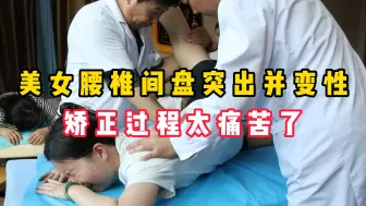 Télécharger la video: 孟祥军罗辉正骨团队-美女腰椎间盘突出并变性矫正过程太痛苦了