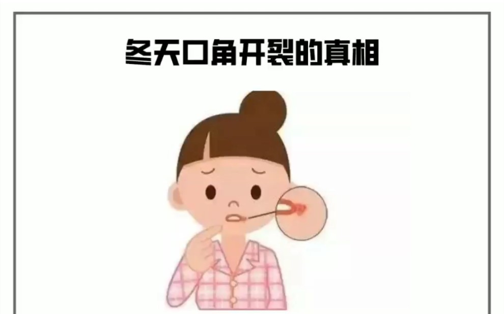 口角干裂真的只是缺水么?