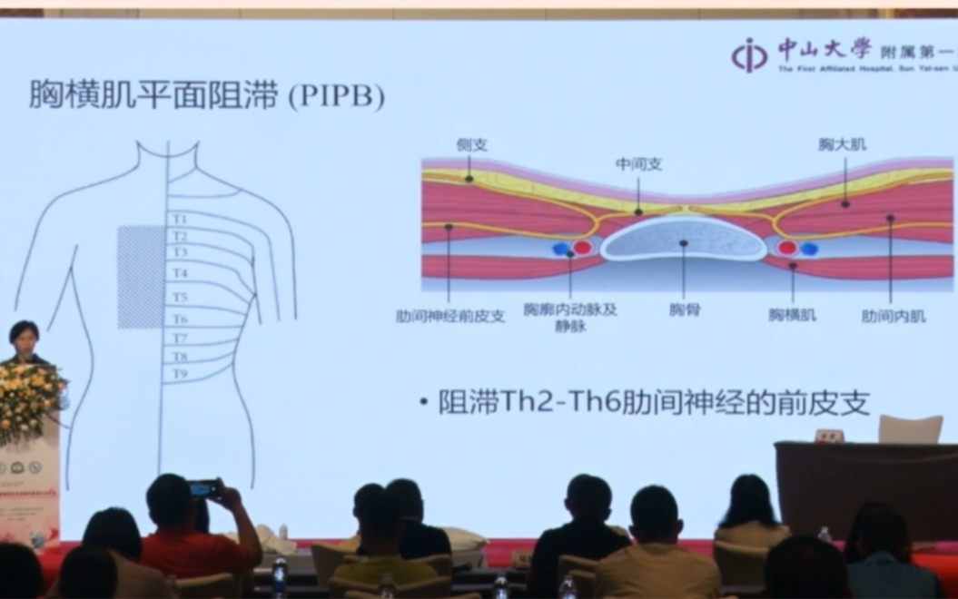 胸横肌平面阻滞PIPB哔哩哔哩bilibili